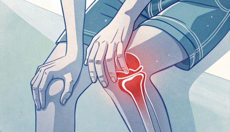 A digital illustration showing bone pain at the knee.